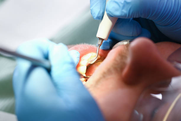 Best Emergency Dental Care for Broken or Chipped Teeth in Slaton, TX