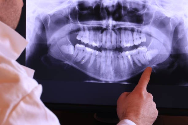 Best Emergency Dental Care for Broken or Chipped Teeth in Slaton, TX