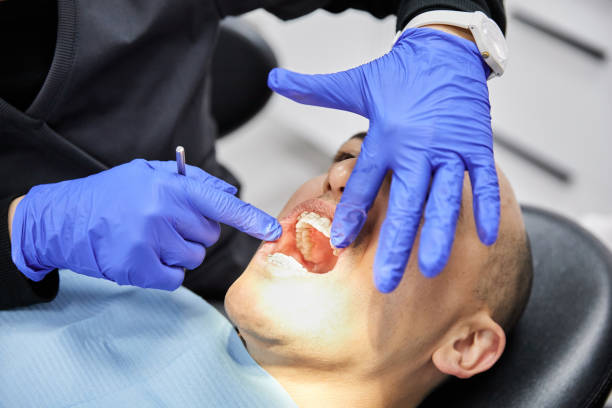 Best Emergency Tooth Extraction in Slaton, TX