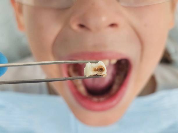 Best Emergency Denture Repair in Slaton, TX